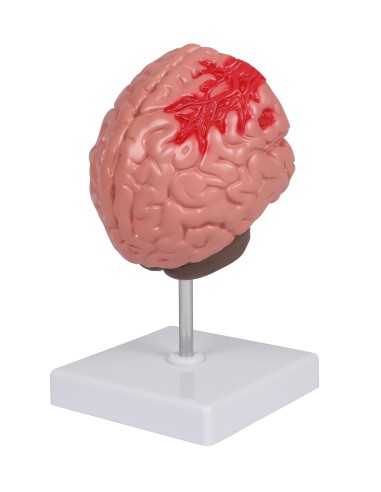 Pathologies of the human brain Erler Zimmer C711