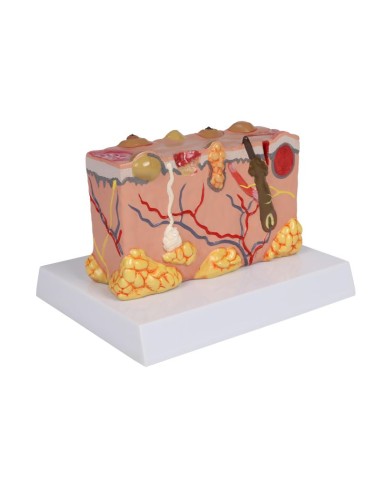 Modèle de peau pathologique, agrandi 30 fois...