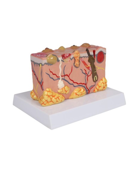 Pathological skin model, magnified 30 times Erler Zimmer EZ-J755