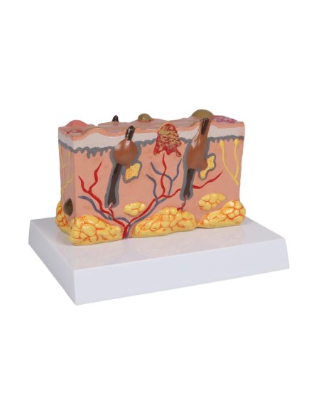 Pathological skin model, magnified 30 times Erler Zimmer EZ-J755