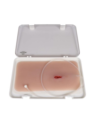 Moulage of stab wound with bleeding Erler...