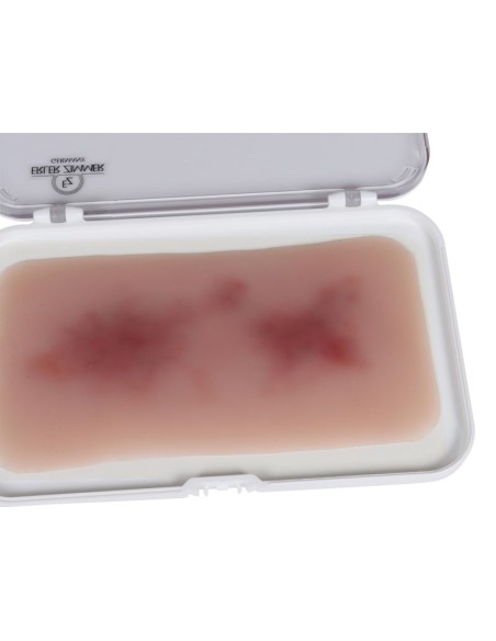 Erler Zimmer EZ-NW117 Moulage para heridas con hematoma fresco