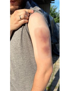 Moulage di Ferita Ematoma Vecchio EZ-NW119 2