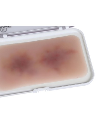 Moulage of Wound Hematoma Old EZ-NW119