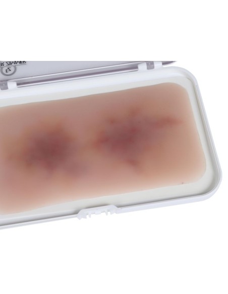 Moulage of Wound Hematoma Old EZ-NW119