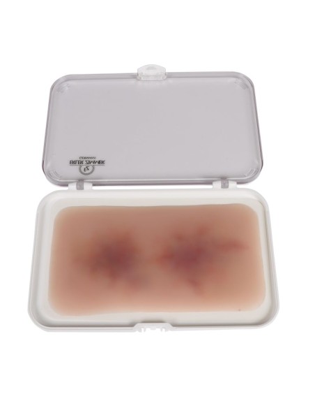 Moulage von Wundhämatomen alt EZ-NW119