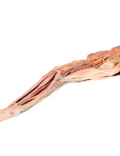 Membres antérieurs du chien – Muscles, tendons,... 2