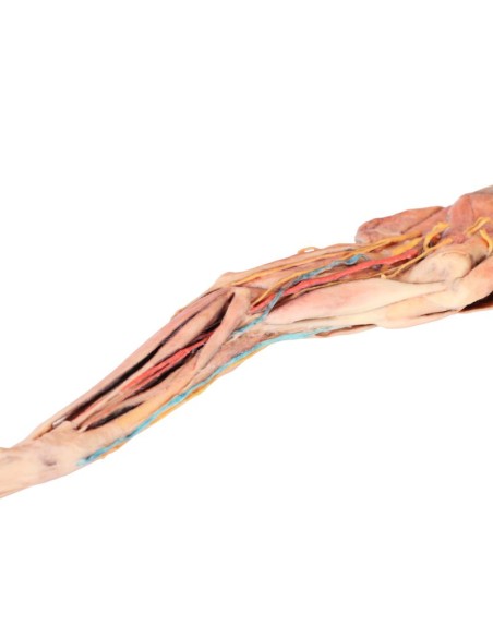 The Dog's Forequarter – Muscles, Tendons, Ligaments, Blood Vessels, and Nerves Distal to the Elbow VP9010