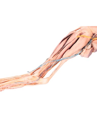 Membres postérieurs du chien – Muscles,...