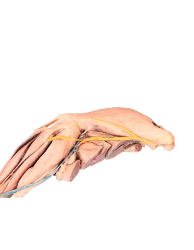 The Dog's Hind Leg – Muscles, Tendons,...