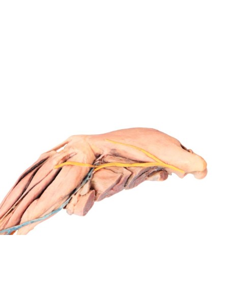 The Dog's Hind Leg – Muscles, Tendons, Ligaments, Blood Vessels, and Nerves Distal to the Knee Joint VP9015