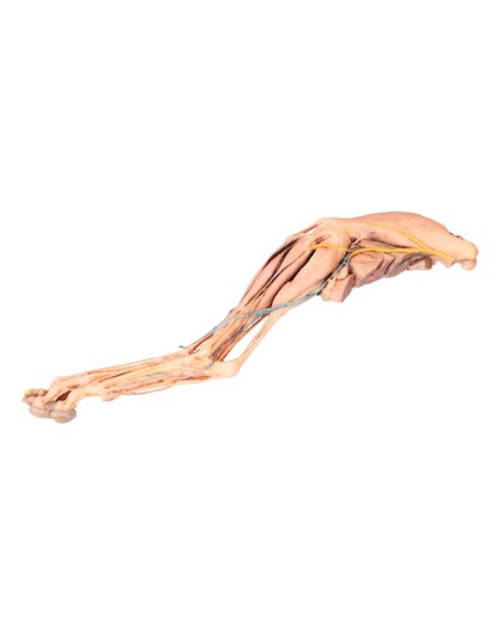 The Dog's Hind Leg – Muscles, Tendons, Ligaments, Blood Vessels, and Nerves Distal to the Knee Joint VP9015