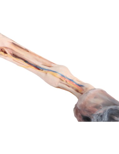 The Horse's Forequarter – Muscles, Tendons,...