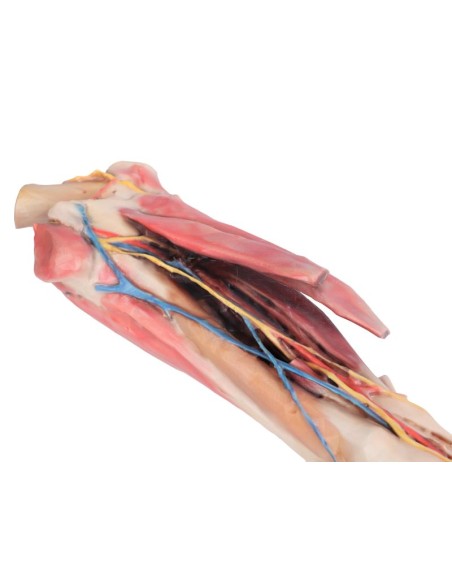 Membre antérieur du cheval – Muscles, tendons, ligaments, vaisseaux et nerfs distaux VP10010