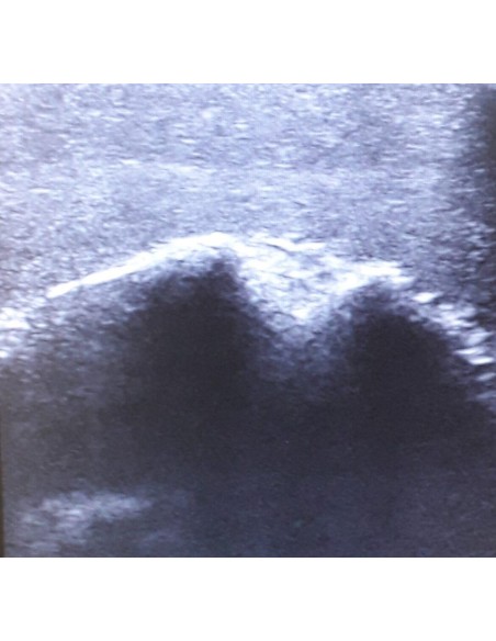 SonoEZ SEZ-SH Shoulder Joint Ultrasound Simulator