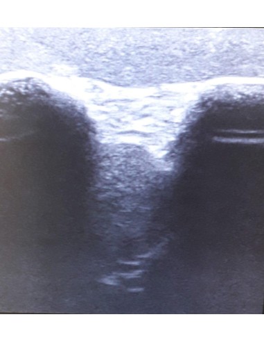 SonoEZ SEZ-SH Shoulder Joint Ultrasound Simulator