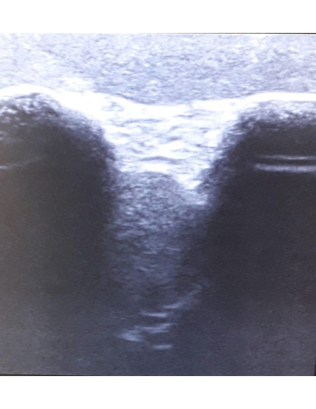 SonoEZ SEZ-SH Shoulder Joint Ultrasound Simulator