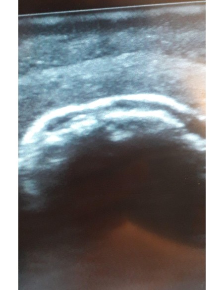 SonoEZ SEZ-SH Shoulder Joint Ultrasound Simulator