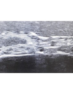 SonoEZ SEZ-FA Facial Ultrasound Trainer 2