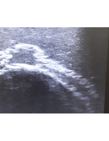 SonoEZ SEZ-FA Facial Ultrasound Trainer