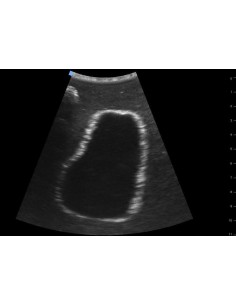 Simulador para ecografía vesical SonoEZ SEZ-BL