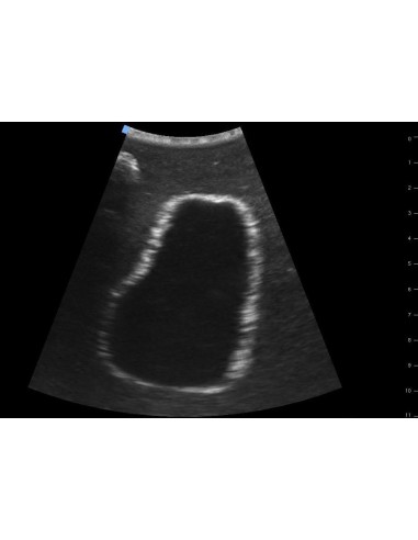 Simulador para ecografía vesical SonoEZ SEZ-BL