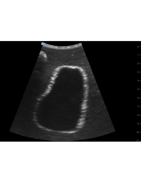 SonoEZ SEZ-BL Bladder Ultrasound Trainer