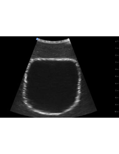 Simulador para ecografía vesical SonoEZ SEZ-BL