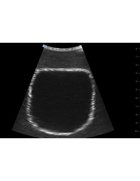 SonoEZ SEZ-BL Bladder Ultrasound Trainer