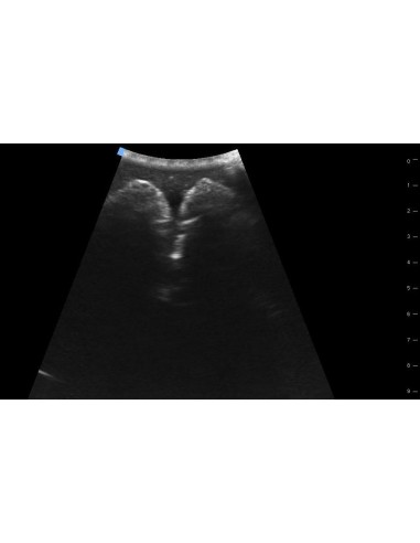 SonoEZ SEZ-BL Bladder Ultrasound Trainer
