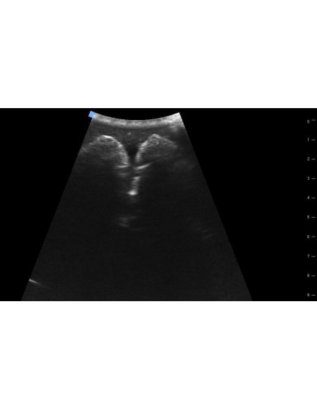 Trainer per ecografica della vescica SonoEZ SEZ-BL