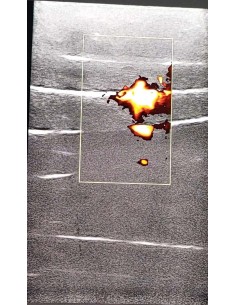 SonoEZ SEZ-FP Fascial Injection Simulator 2