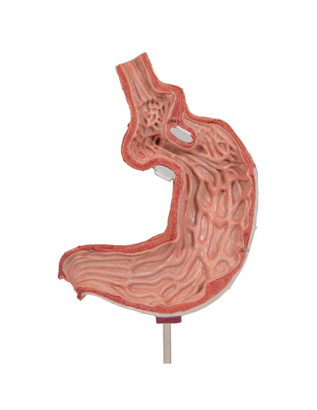 3B Scientific K15/1 Gastric Bandage Model