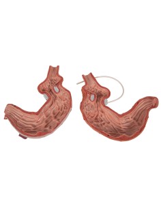 3B Scientific K15/1 Gastric Bandage Model 2