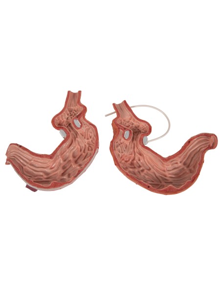 Modello di bendaggio gastrico 3B Scientific K15/1