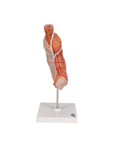 Maquette de bandage gastrique 3B Scientific K15/1