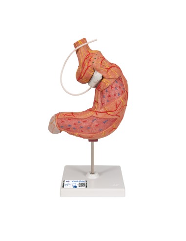 Maquette de bandage gastrique 3B Scientific K15/1