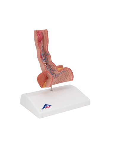 Anatomisches Modell „Erkrankungen der...