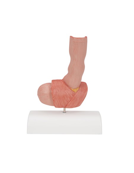 Anatomisches Modell „Erkrankungen der Speiseröhre“ von 3B Scientific K18