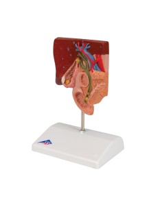 Anatomisches Modell von Gallensteinen, 3B Scientific K26