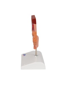 Anatomisches Modell von Gallensteinen, 3B Scientific K26 2