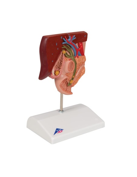 Anatomisches Modell von Gallensteinen, 3B Scientific K26