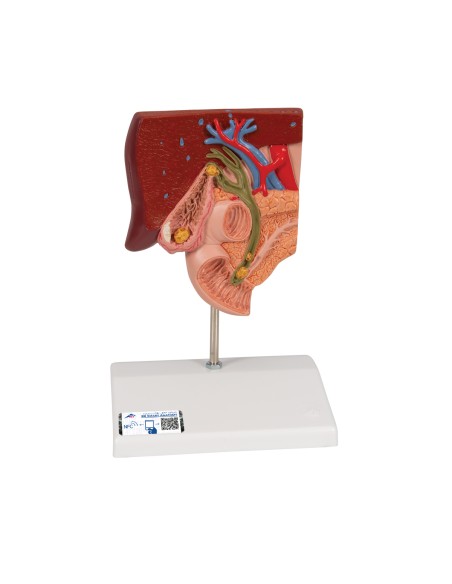 Anatomisches Modell von Gallensteinen, 3B Scientific K26
