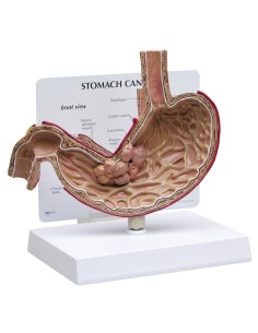 3B Scientific, MICROanatomy, Modello di Fegato K24