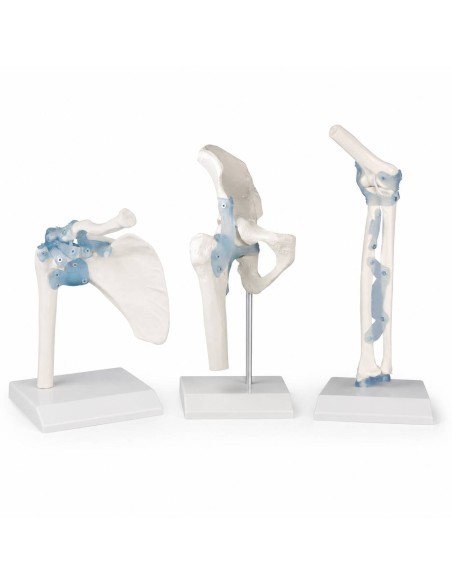 Kit modelli anatomici articolari: spalla, gomito e anca con legamenti Erler Zimmer