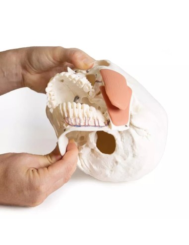 Modello di cranio per odontoiatria con sindrome...