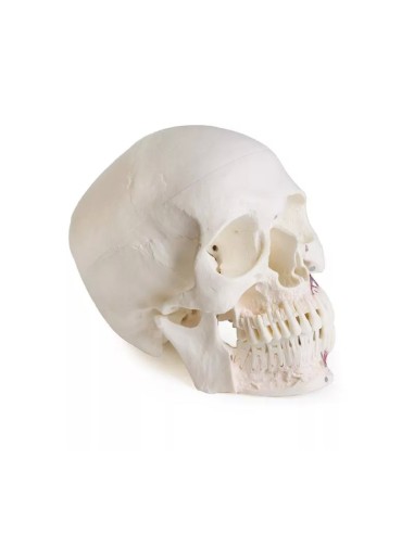 Modello di cranio per odontoiatria con sindrome...