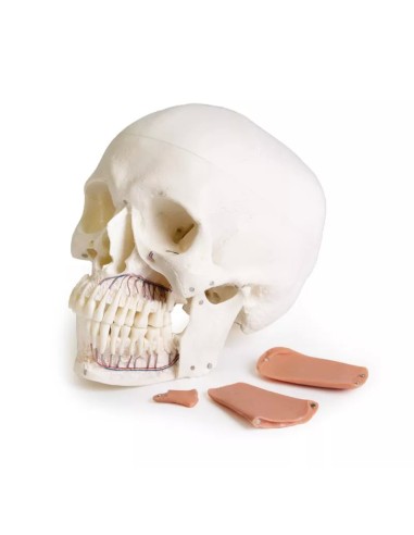 Modello di cranio per odontoiatria con sindrome...