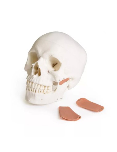 Modello di cranio per odontoiatria con sindrome...