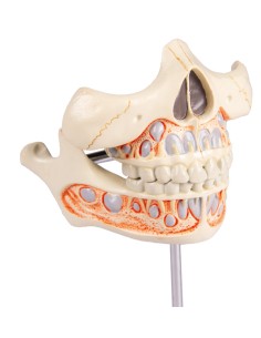 Maqueta de la dentición de leche de un niño de 5 años,...